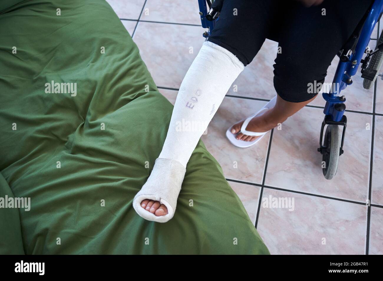 closeup of a leg with plaster Stock Photo
