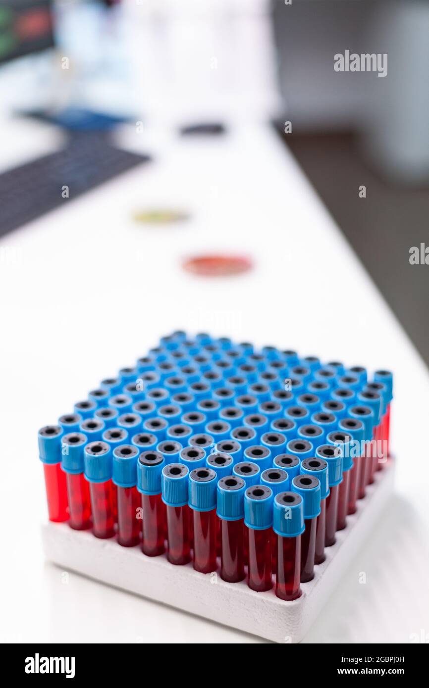 Vacutainer tubes for collecting blood samples during biological chemistry examination in