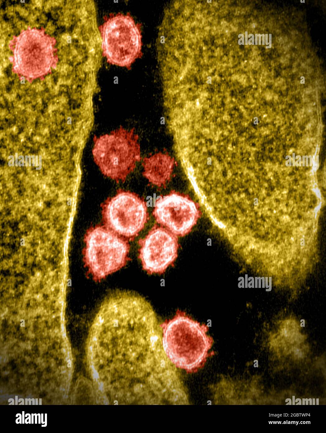 Novel Coronavirus SARS-CoV-2 This transmission electron microscope image shows SARS-CoV-2—also known as 2019-nCoV, the virus that causes COVID-19. Virus particles are shown emerging from the surface of a cell cultured in the lab. The spikes on the outer edge of the virus particles give coronaviruses their name, crown-like. Image captured and colorized at Rocky Mountain Laboratories in Hamilton, Montana. Credit: NIAID Stock Photo