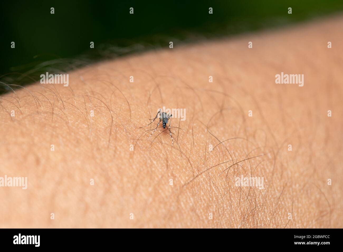 Asian tiger mosquito (Aedes albopictus) biting skin and feeding on human blood Stock Photo