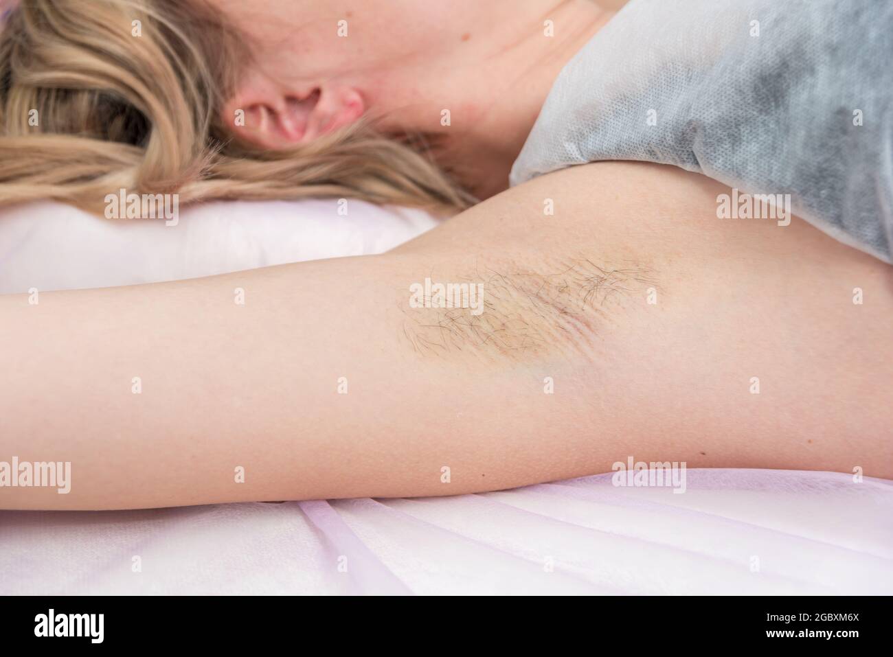 Girl is ready for depilation of her armpits in spa salon Stock Photo