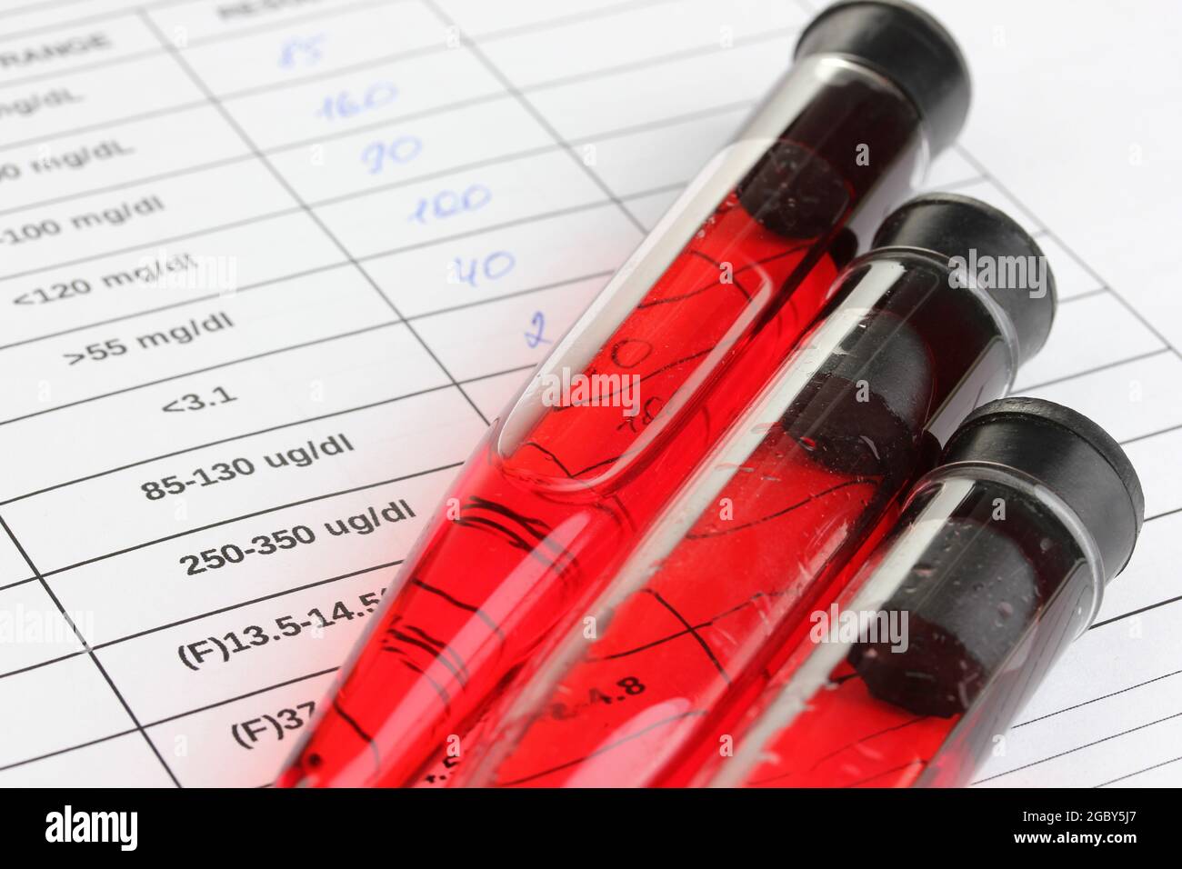 Blood in test tubes and results close up Stock Photo Alamy