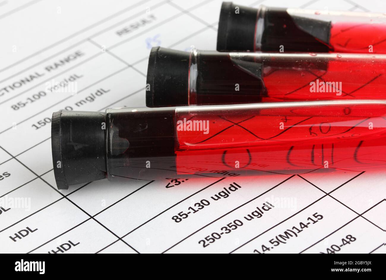 Blood in test tubes and results close up Stock Photo Alamy
