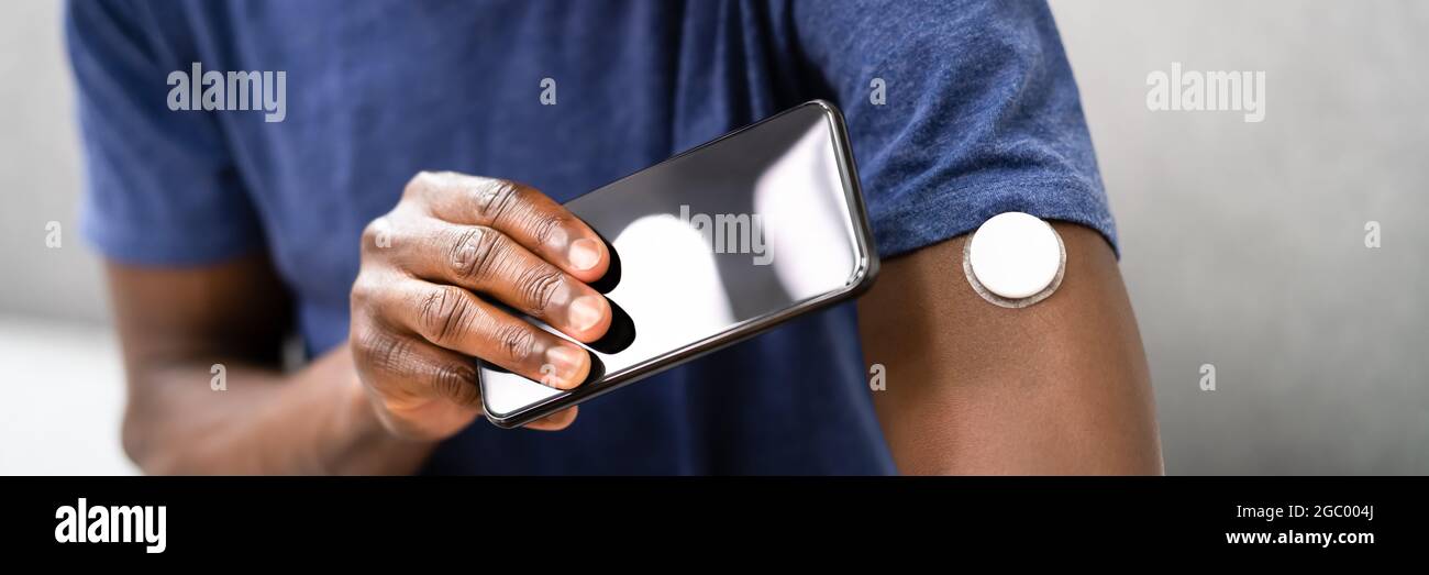Continuous Glucose Blood Check Using Smartphone. Patient With Diabetes