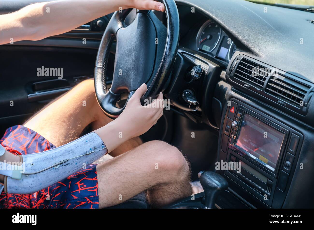 Prosthetic amputated hand of Caucasian man on the steering wheel who drives car Stock Photo