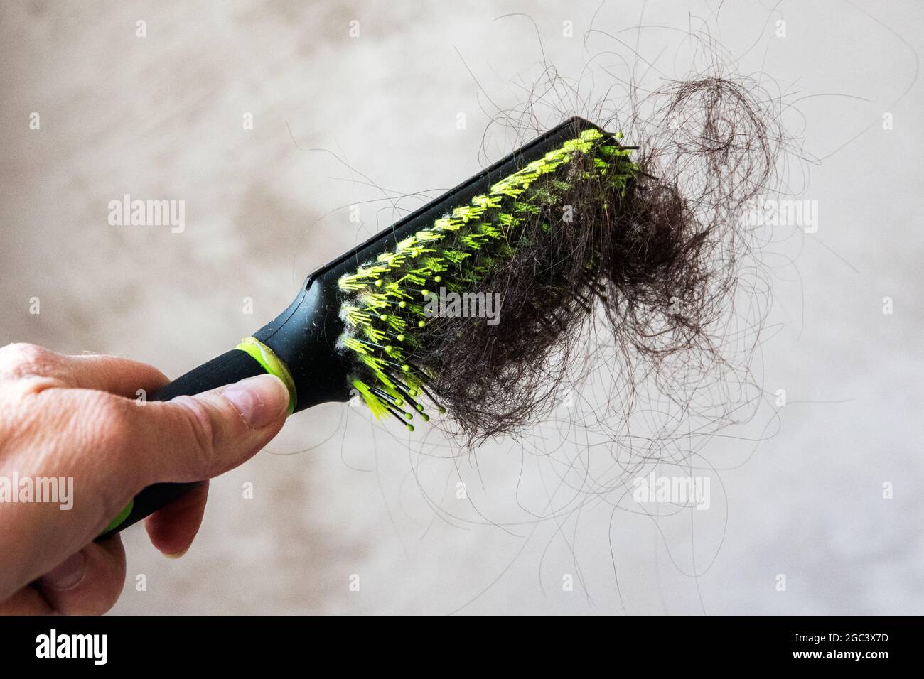 A closeup view of a female hand holds a clump of hair stuck to