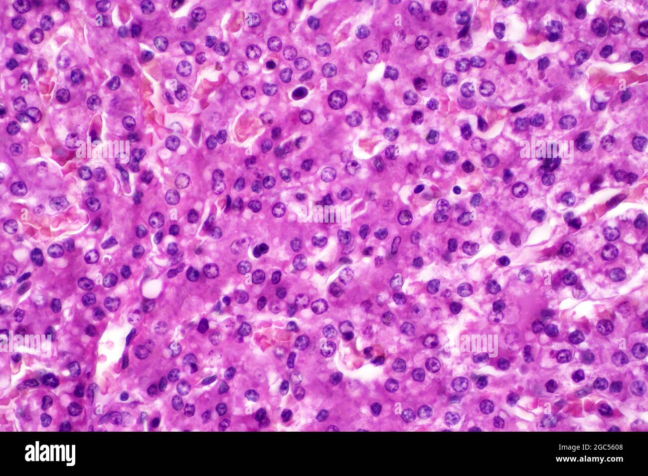 Hepatocyte cells, light micrograph Stock Photo