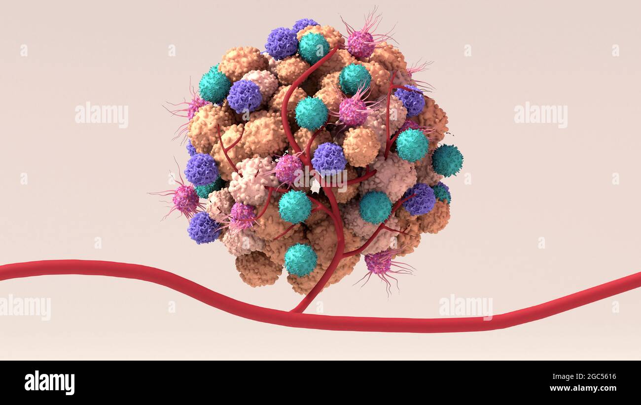 Tumour microenvironment, illustration Stock Photo - Alamy