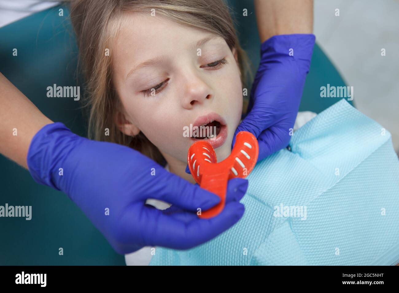 Dentist making teeth impressions of a child patient, using dental putty Stock Photo