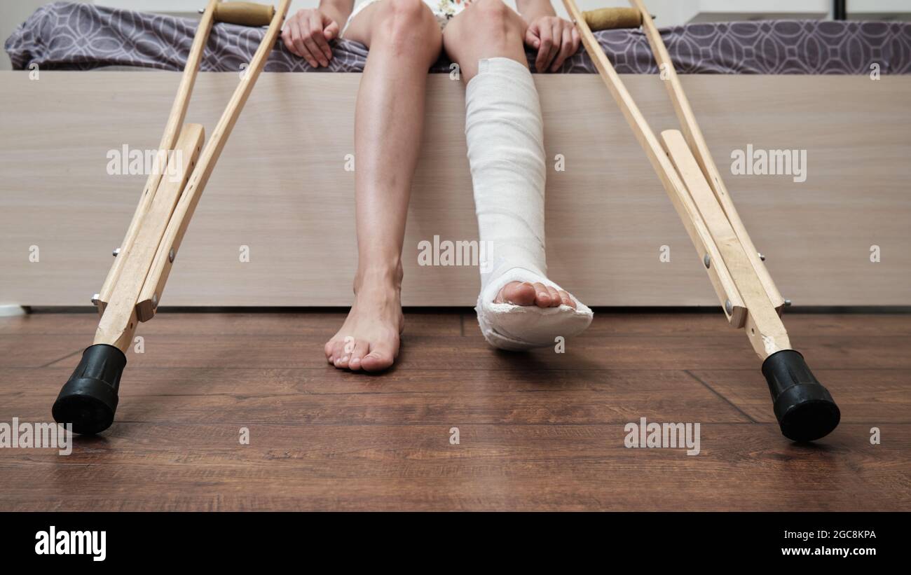 Bone broken injured ill hires stock photography and images Alamy