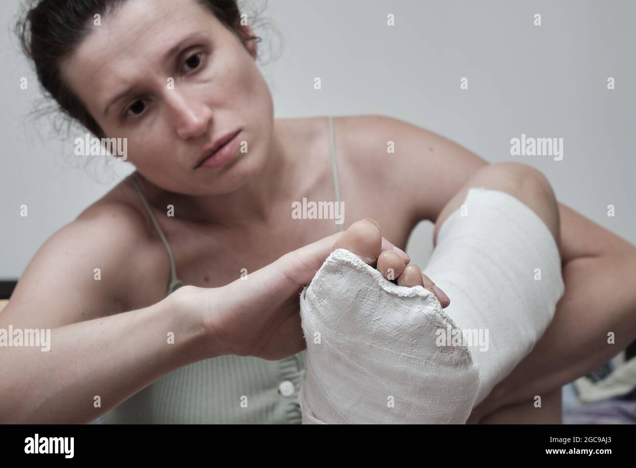 Broken Leg Bed High Resolution Stock Photography and Images Alamy