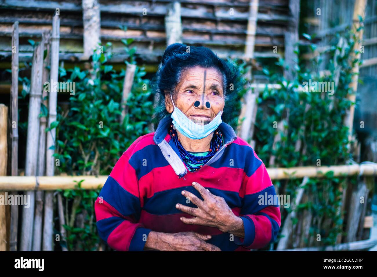 apatani tribal women facial expression with her traditional nose lobes and blurred background image is taken at ziro arunachal pradesh india. it is on Stock Photo