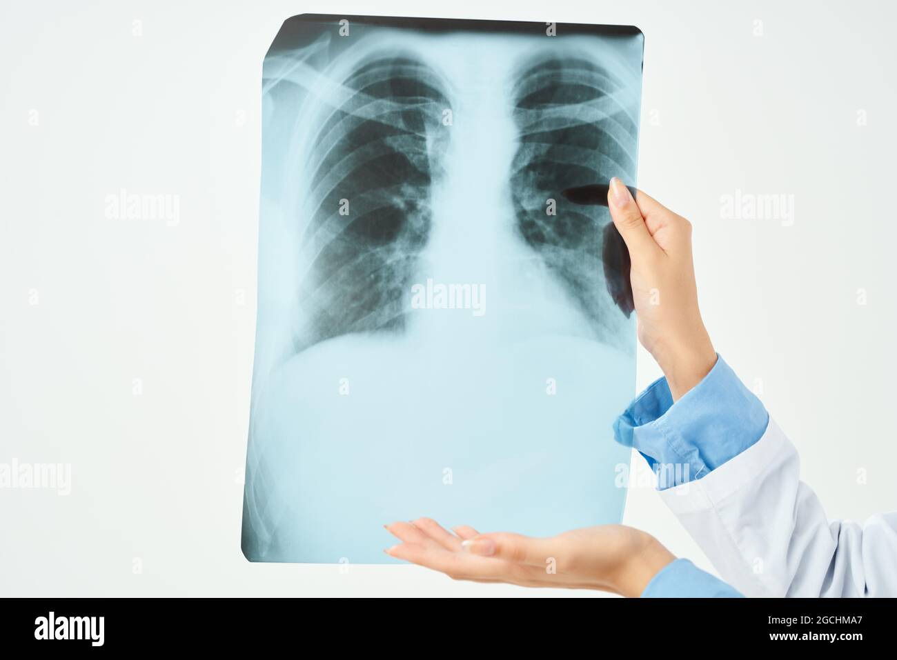 Xray diagnosis radiologist profession hospital Stock Photo Alamy