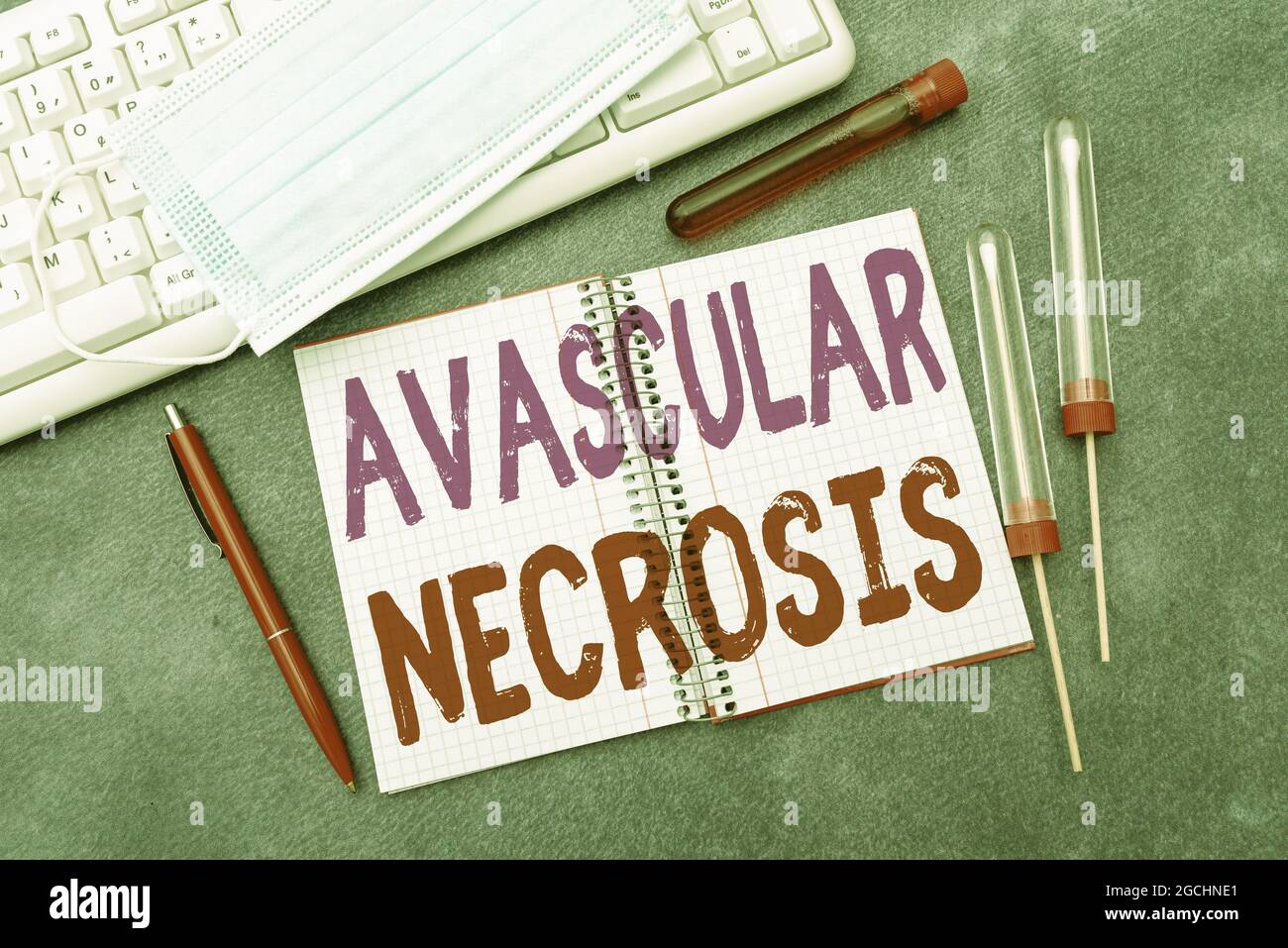 Hand writing sign Avascular Necrosis. Word for death of bone tissue due