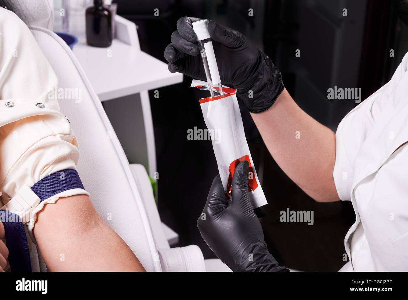New sterile blood tube is removed from a package before blood sample test. Platelet-rich plasma therapy. Cosmetology and skin care. Stock Photo