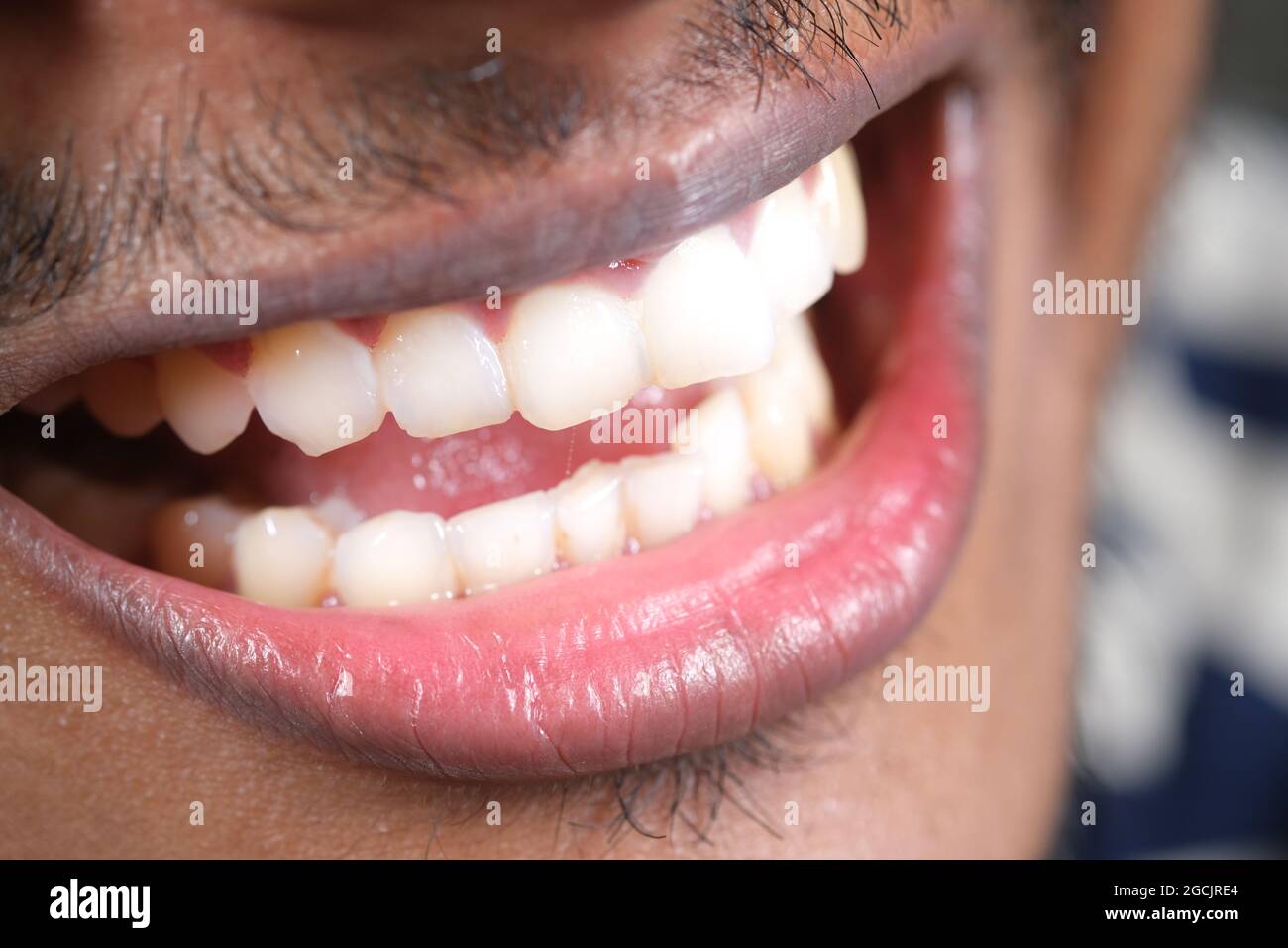 young man open mount checking his teeth  Stock Photo
