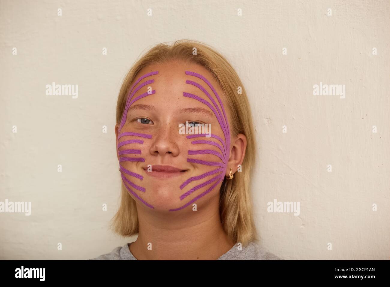 Girl's face with glued kinesiological tapes for lymphatic drainage Stock Photo