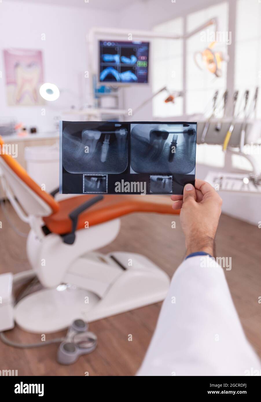Radiologist looking at dental teeth jaw medical radiography working at