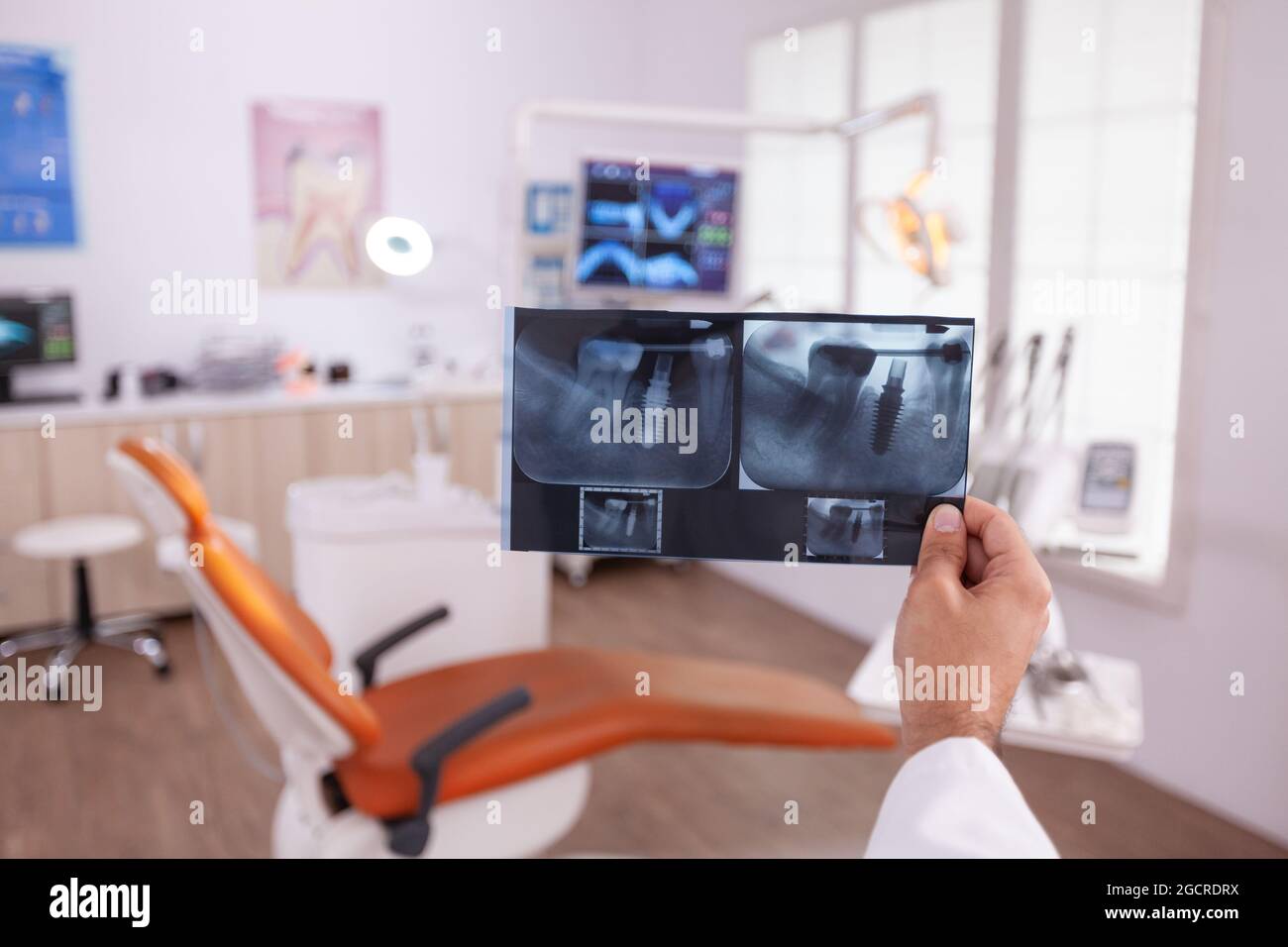 Orthodontist radiologist doctor holding teeth jaw surgery radiography