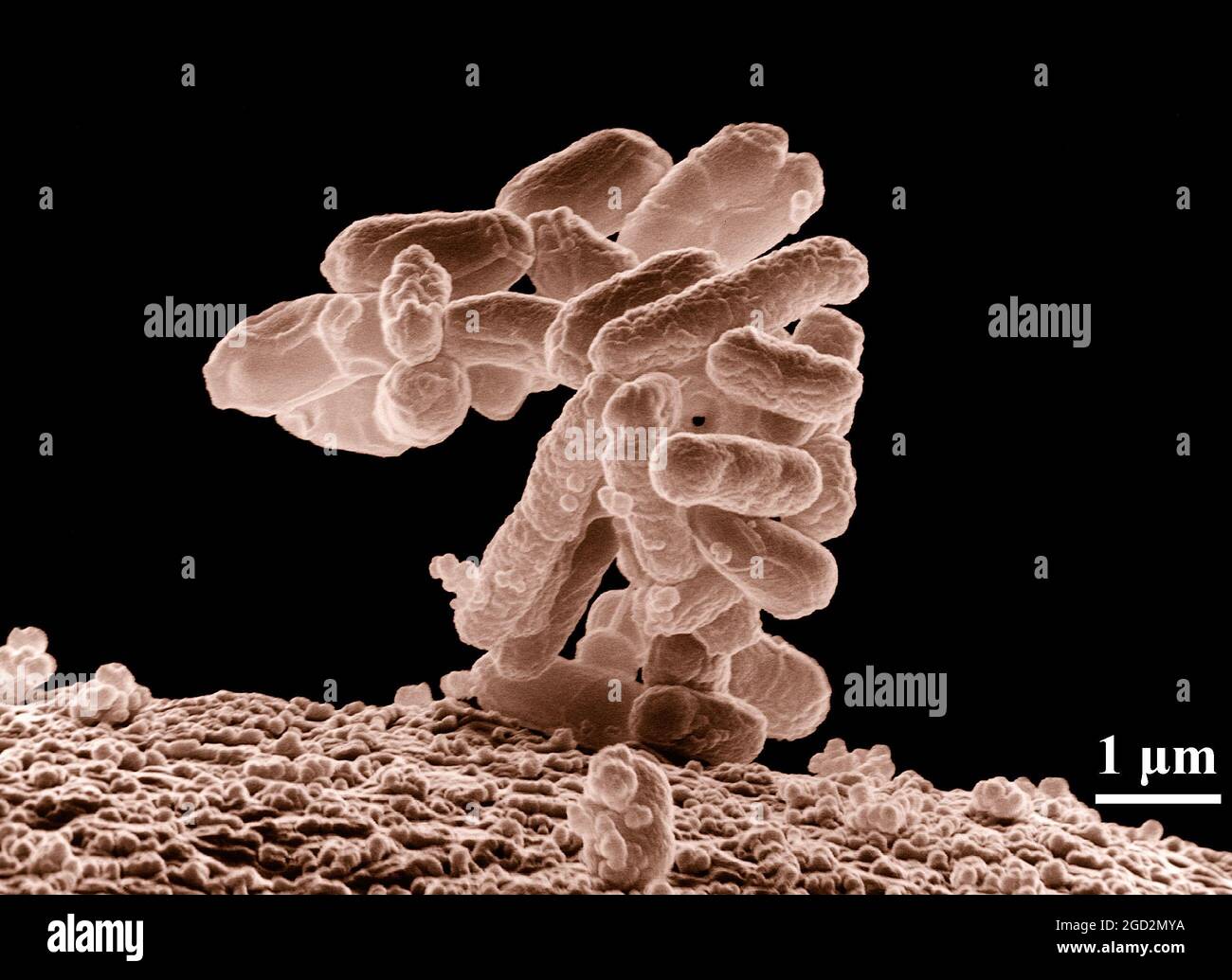 Lowtemperature electron micrograph of a cluster of E. coli bacteria
