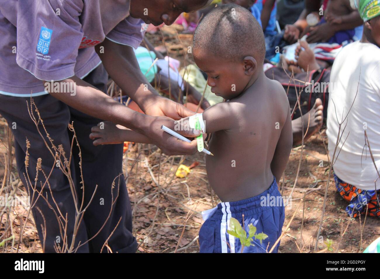 A village health worker checks a child's Mid-Upper Arm Circumference ca. 30 November 2016 Stock Photo