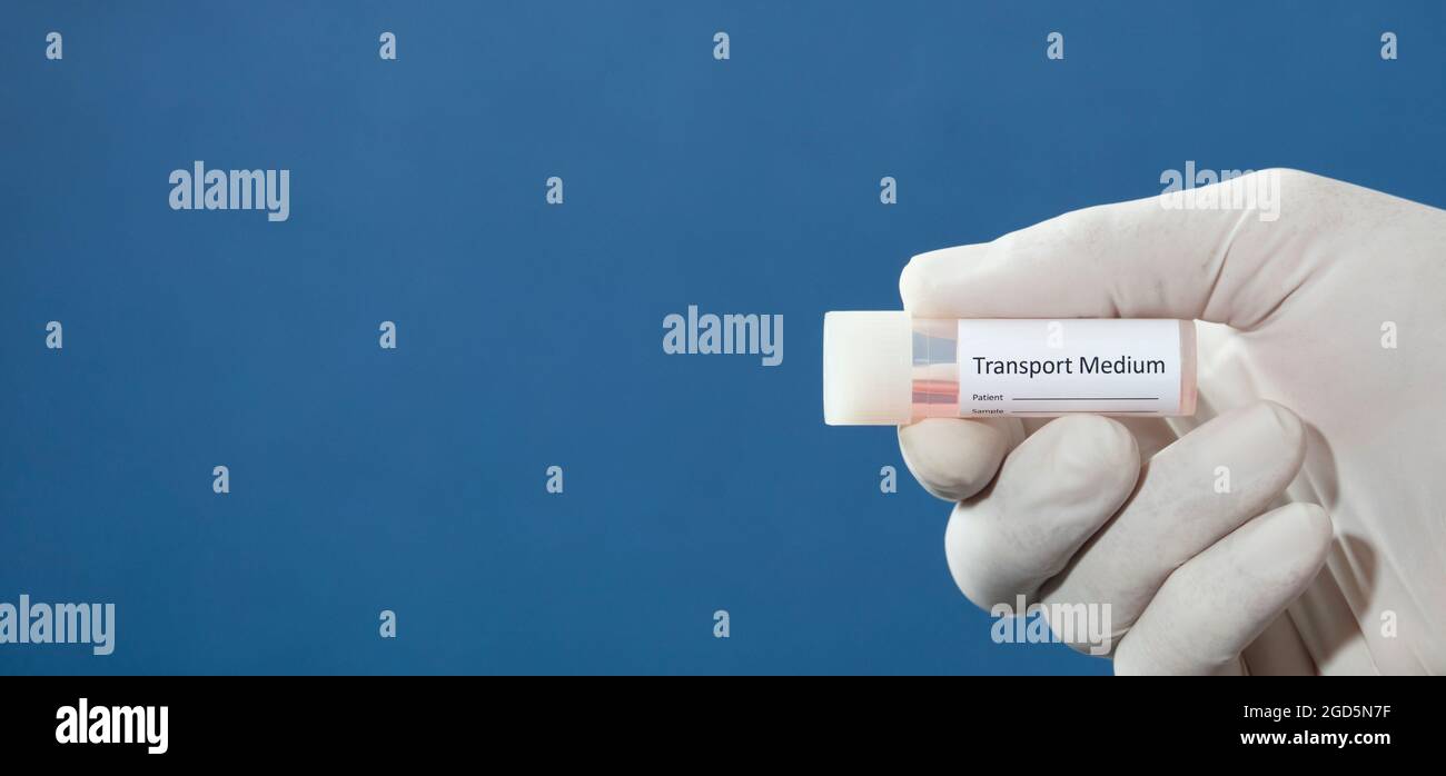 Transport Pcr Examples transport vial for pcr test, in the hands of a doctor, nurse ...