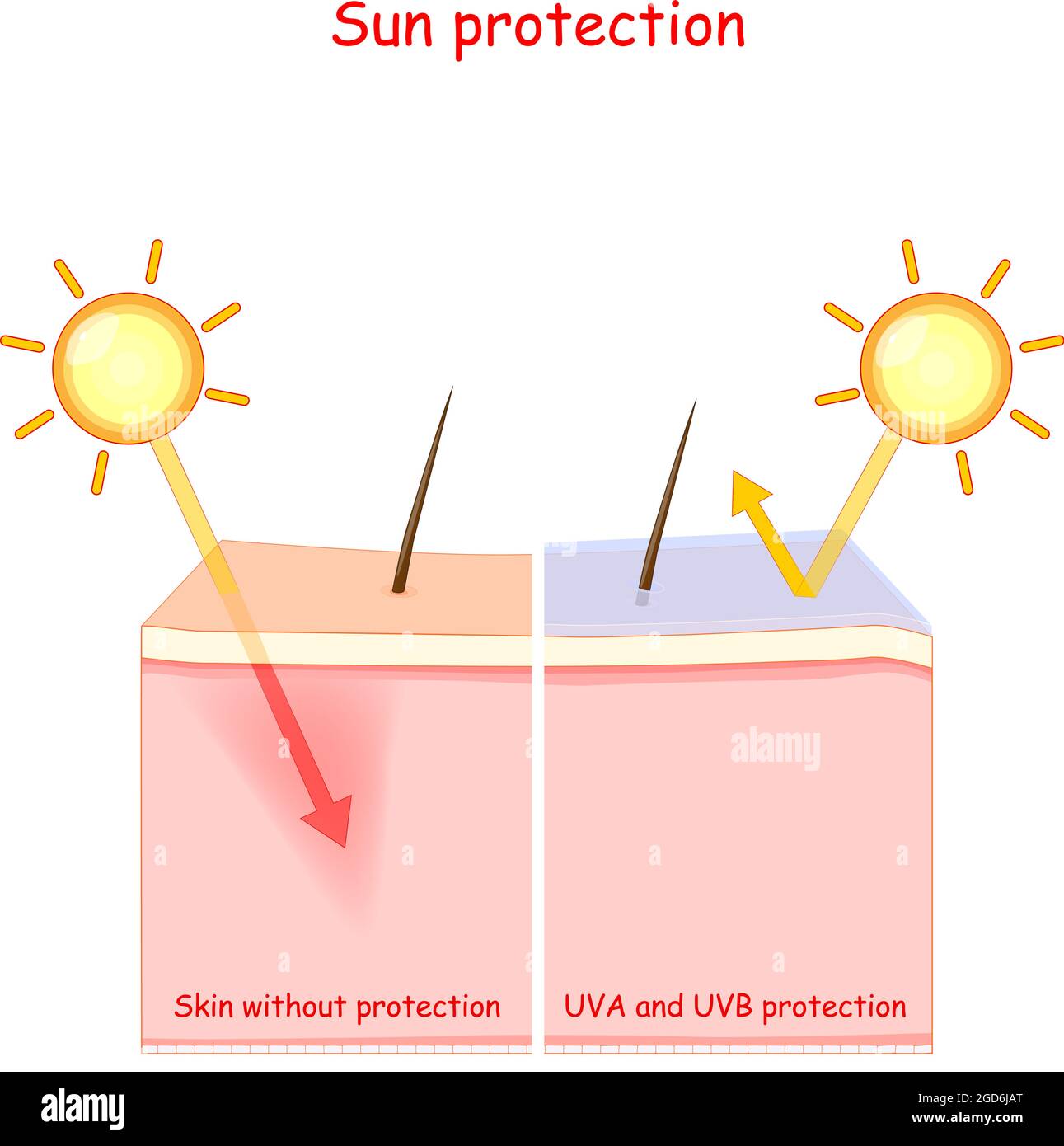 Skin layers. Sun protection. lotion for UVA and UVB rays. Vector illustration. Stock Vector