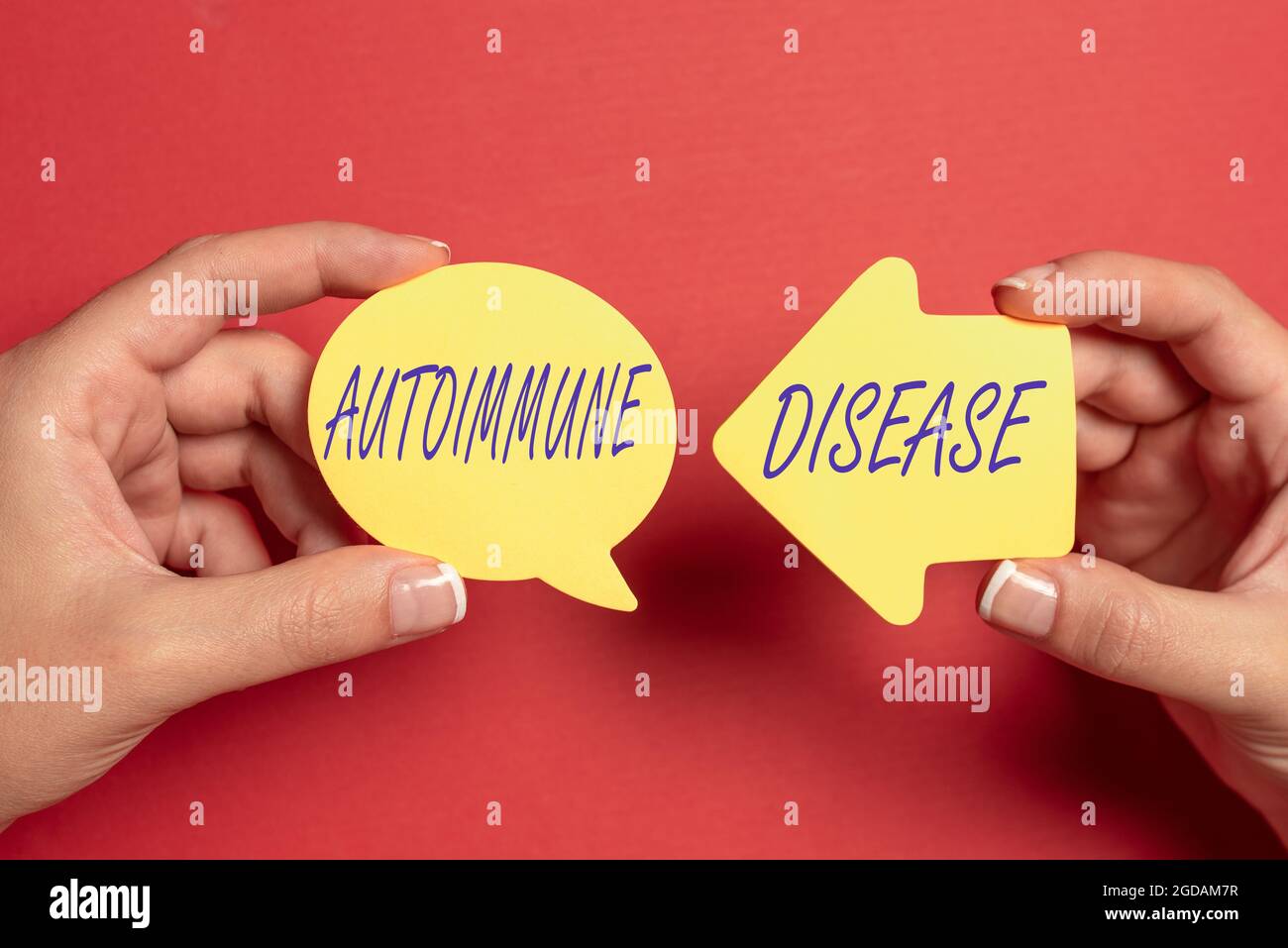 Text sign showing Autoimmune Disease. Business concept body tissues are ...