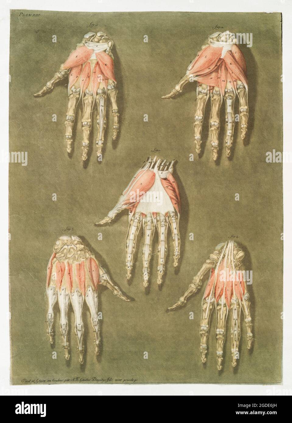 18th-century-medical-drawing-high-resolution-stock-photography-and