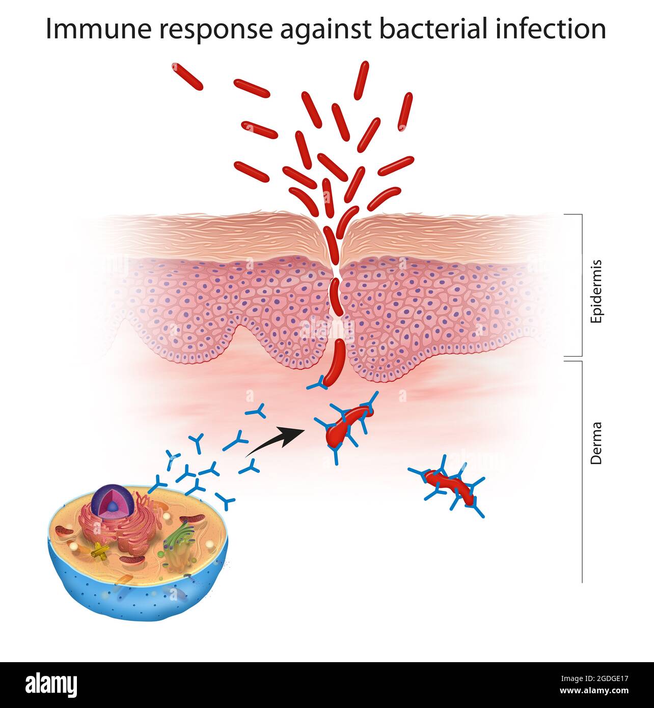 Immune response against bacterial infection Stock Photo