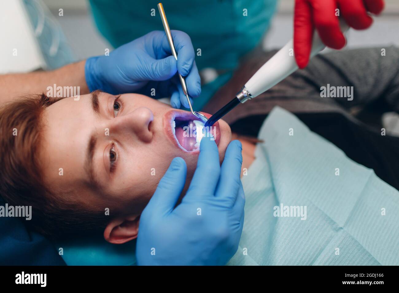 Dentistry. Dentist and patient. Light curing seal. UV dental lamp and