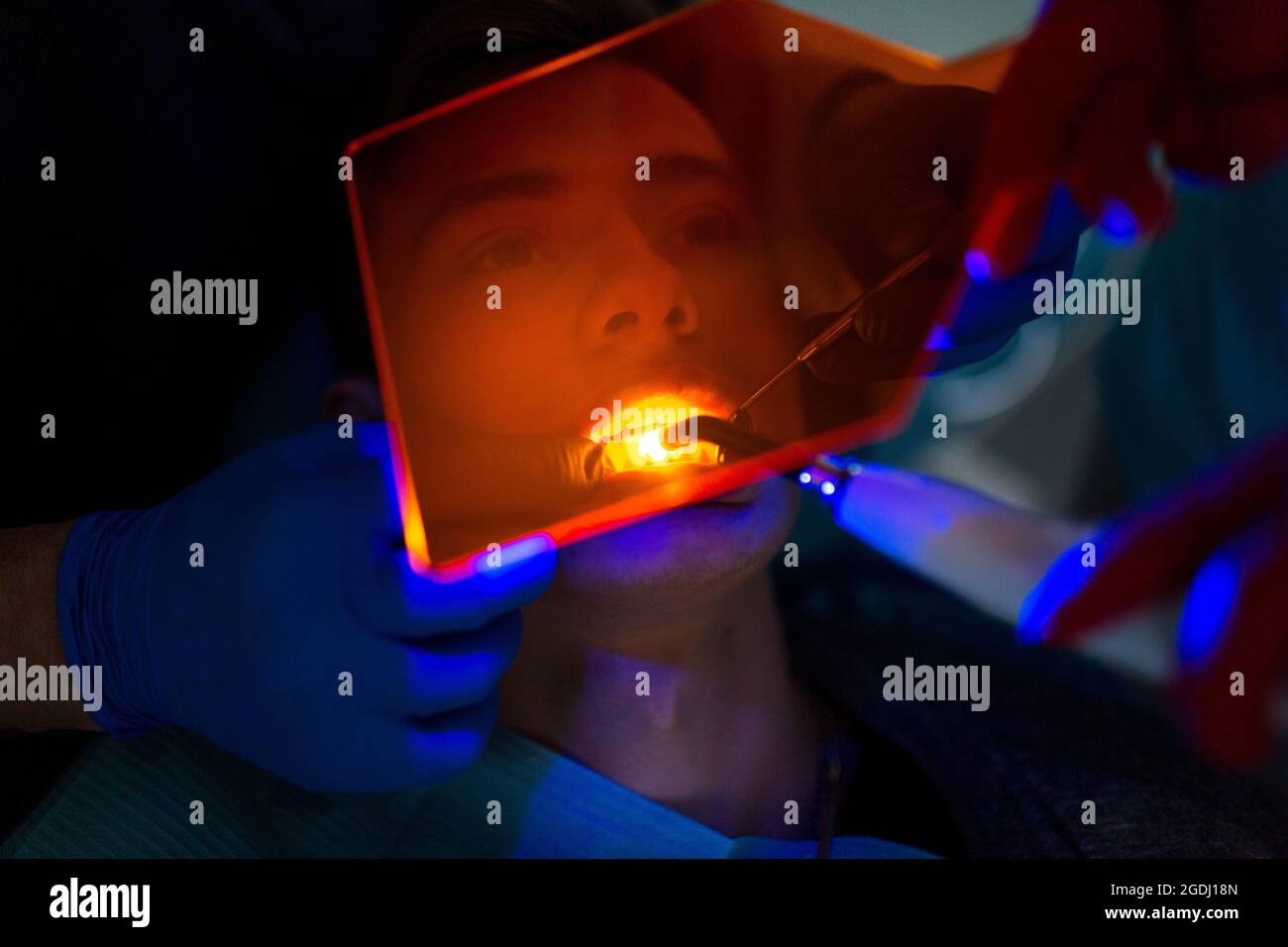 Dentistry. Dentist and patient. Light curing seal. UV dental lamp and