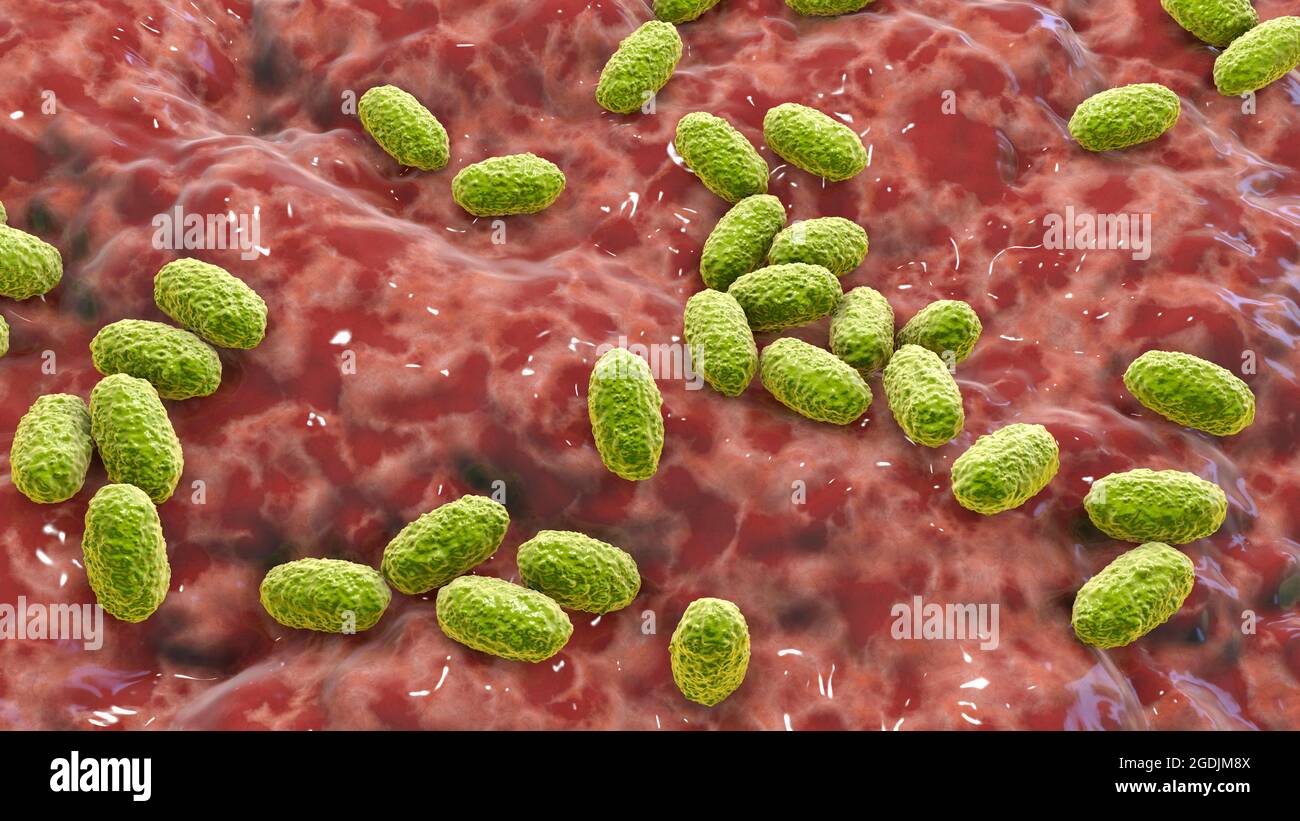 Bordetella pertussis, illustration Stock Photo - Alamy