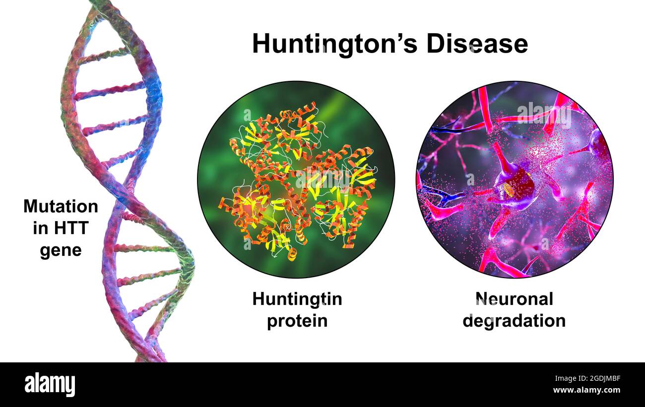 Huntington's disease, conceptual illustration Stock Photo