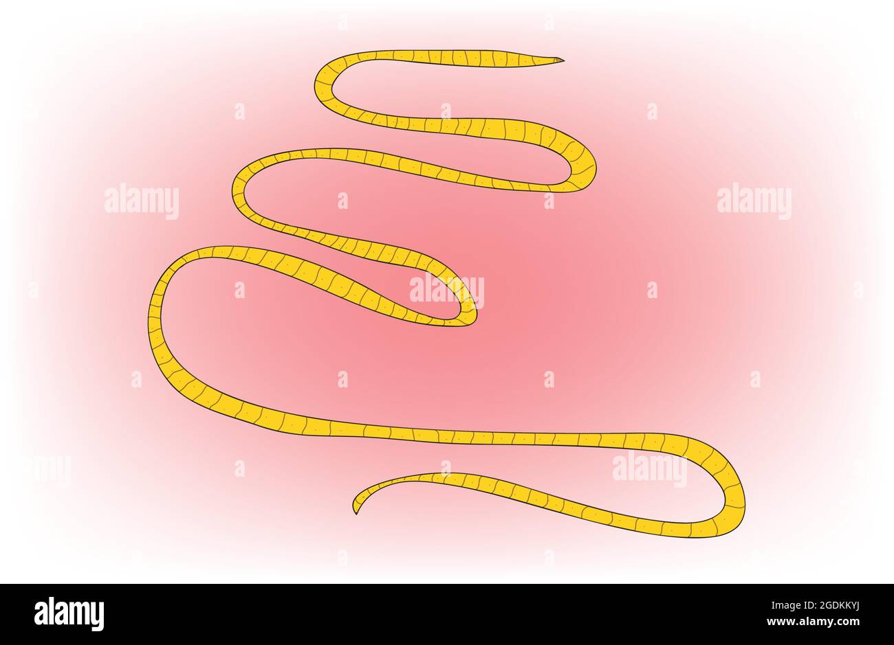taenia solium, Pork tapeworm, Biological anatomy of long taenia solium pork tapeworm Stock Vector