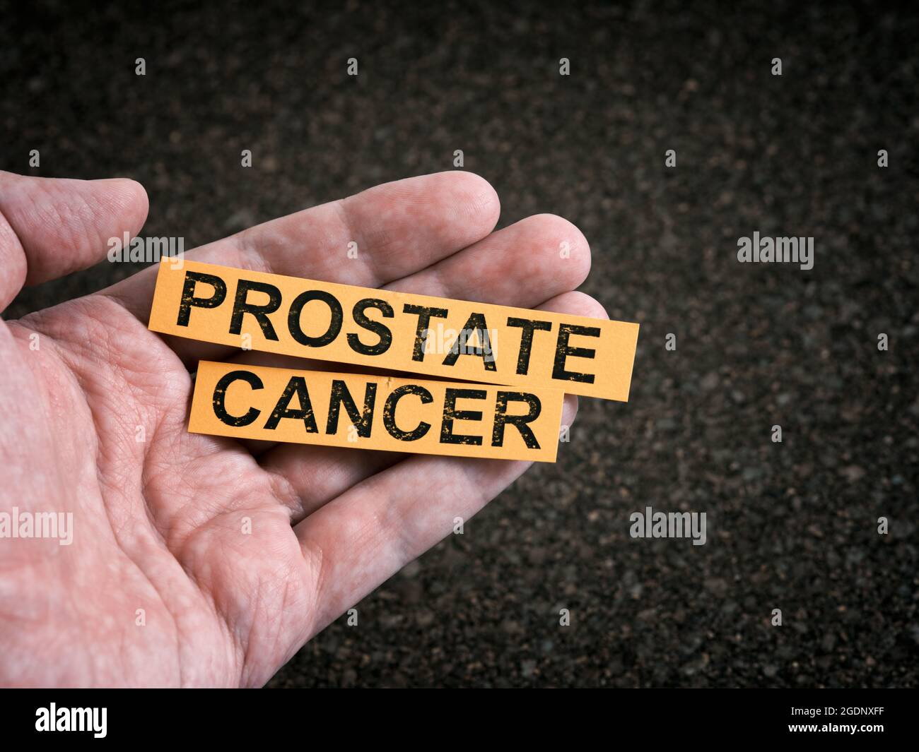 A man holding yellow pieces of paper with the words Prostate Cancer on them in his hand. Close up. Stock Photo