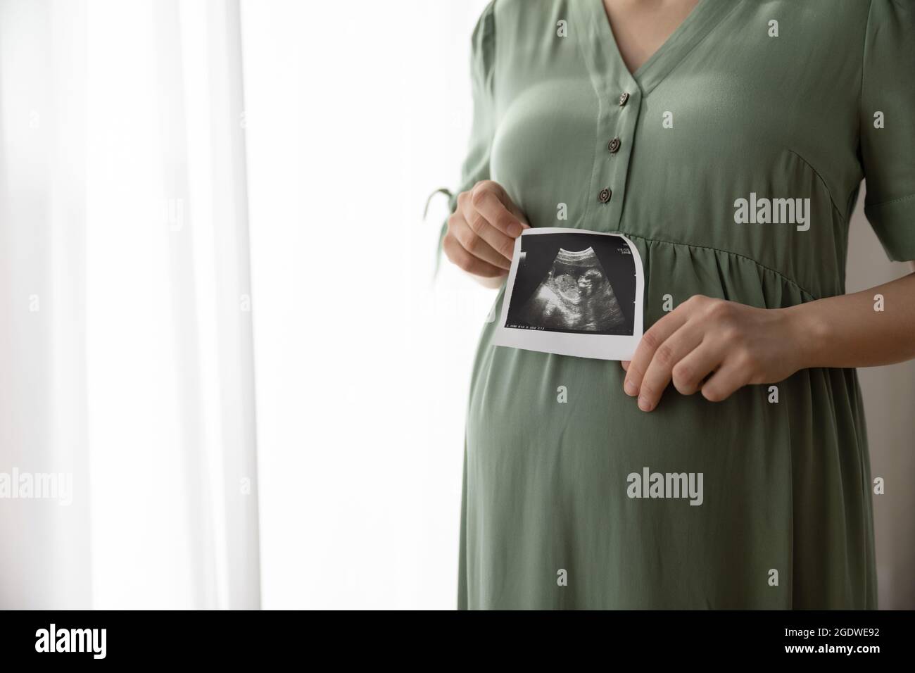 Pregnant woman showing unborn baby sonogram image at camera Stock Photo