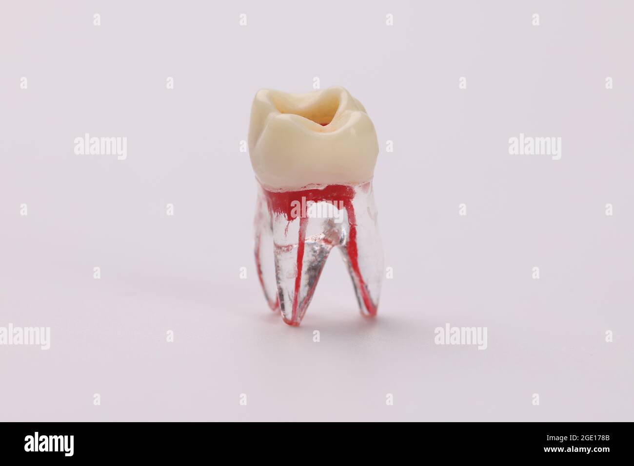 Closeup of plastic tooth dummy with blood vessels on white background Stock Photo