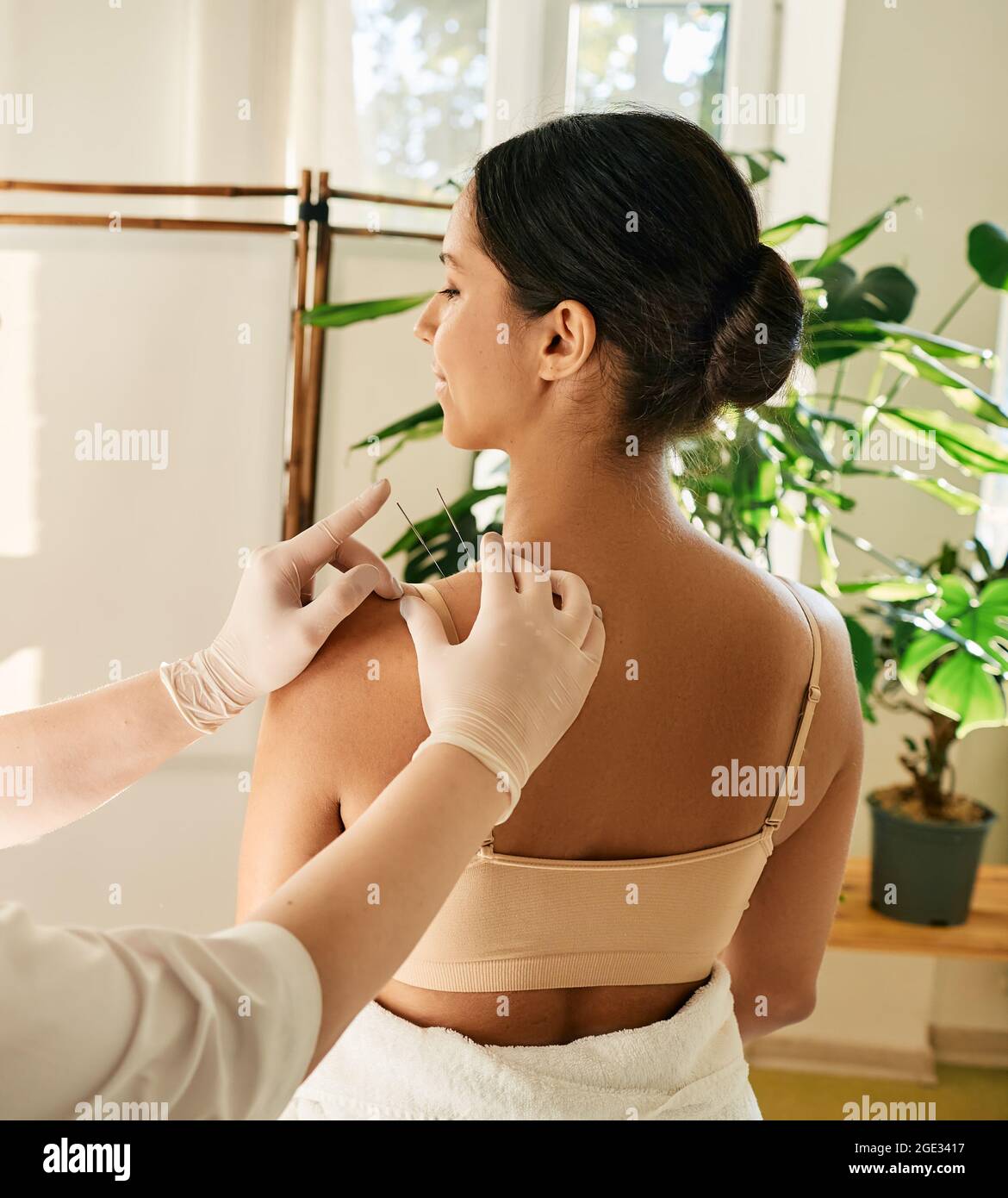 Adult woman relaxing and enjoying during acupuncture procedure. Shoulder acupressure, puncture of a meridian point on body patient Stock Photo