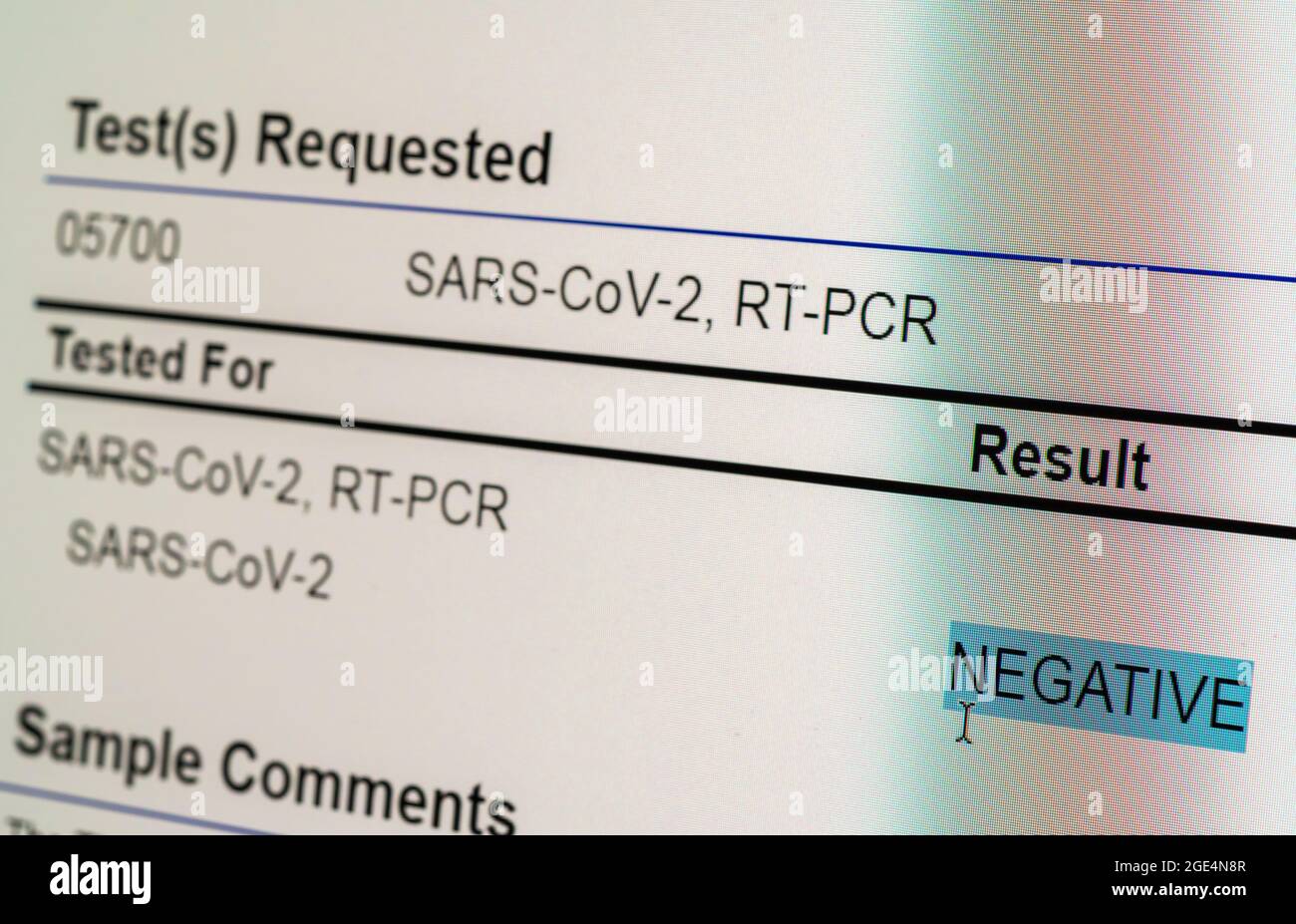 Computer screen showing a negative result for PCR test on nasal swab ...