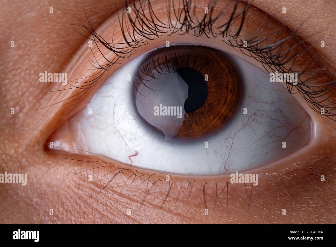 High magnification brown human eye looking up Stock Photo Alamy