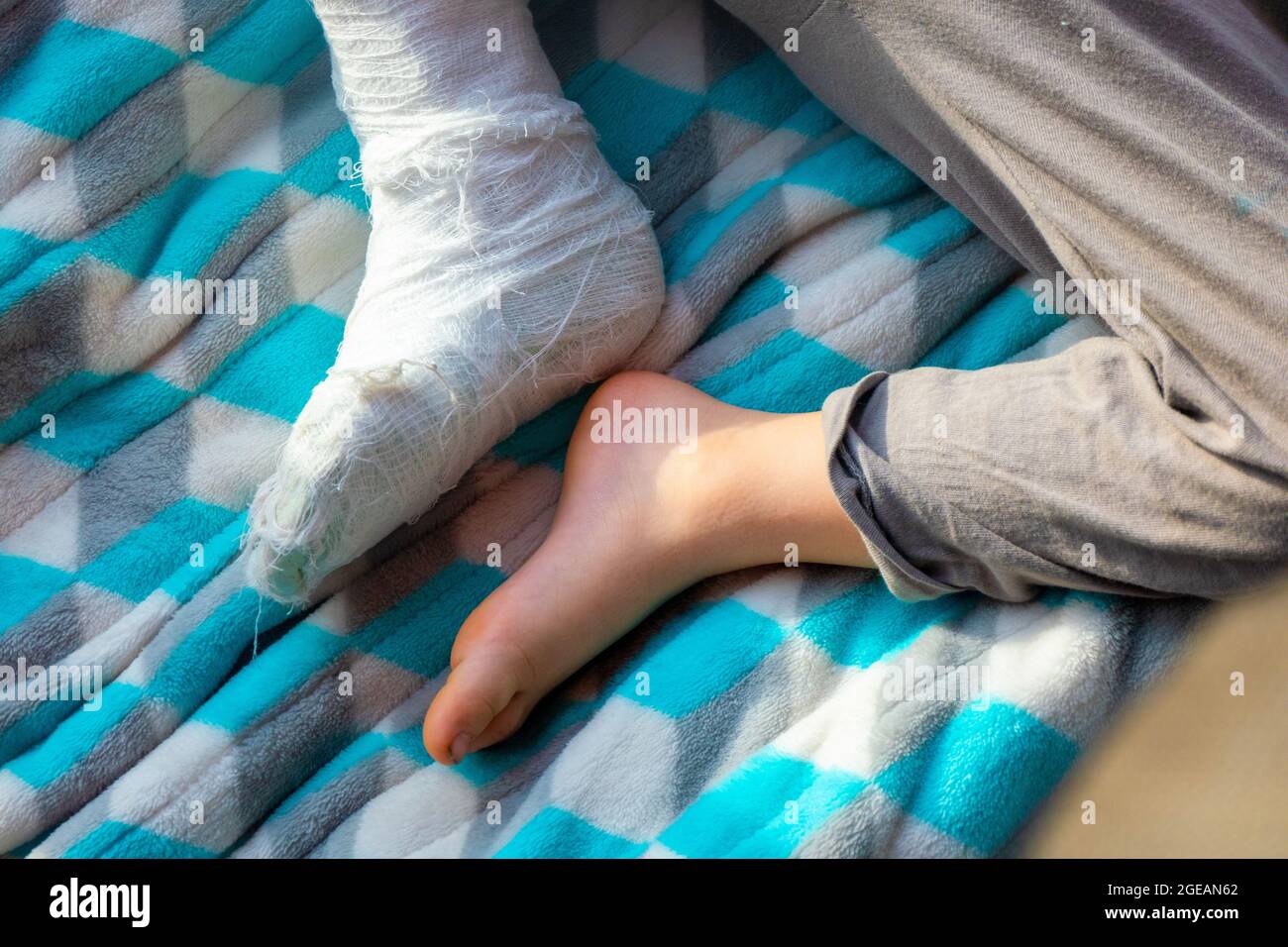 Child with bandage on leg heel fracture. Broken right foot, splint of toddler. Little boy