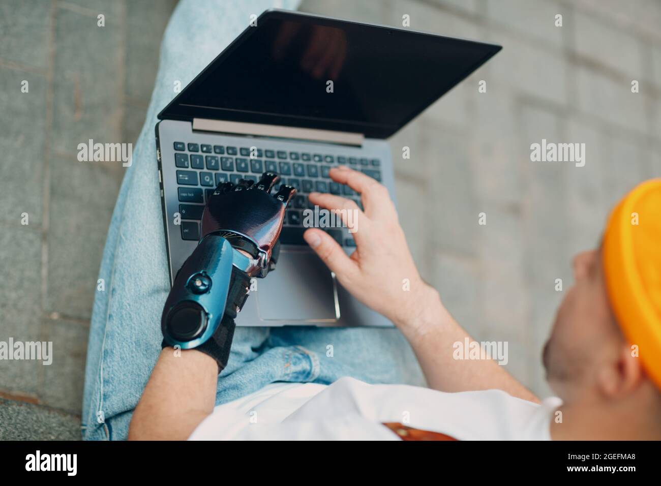 Young disabled man with artificial prosthetic hand using typing on laptop keys computer keyboard Stock Photo