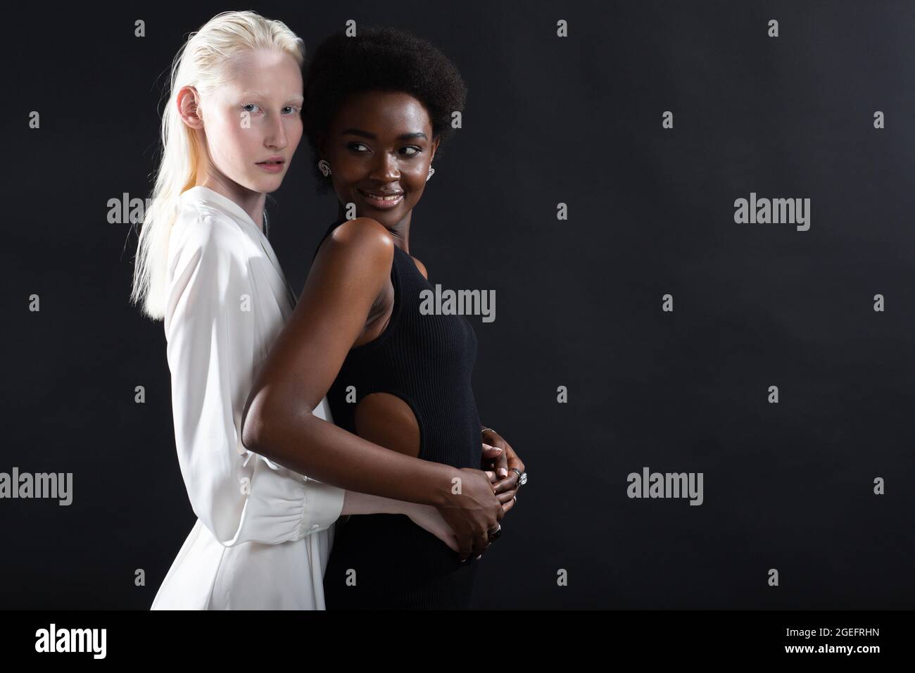 Caucasian albino girl and african american young woman hugging on black ...
