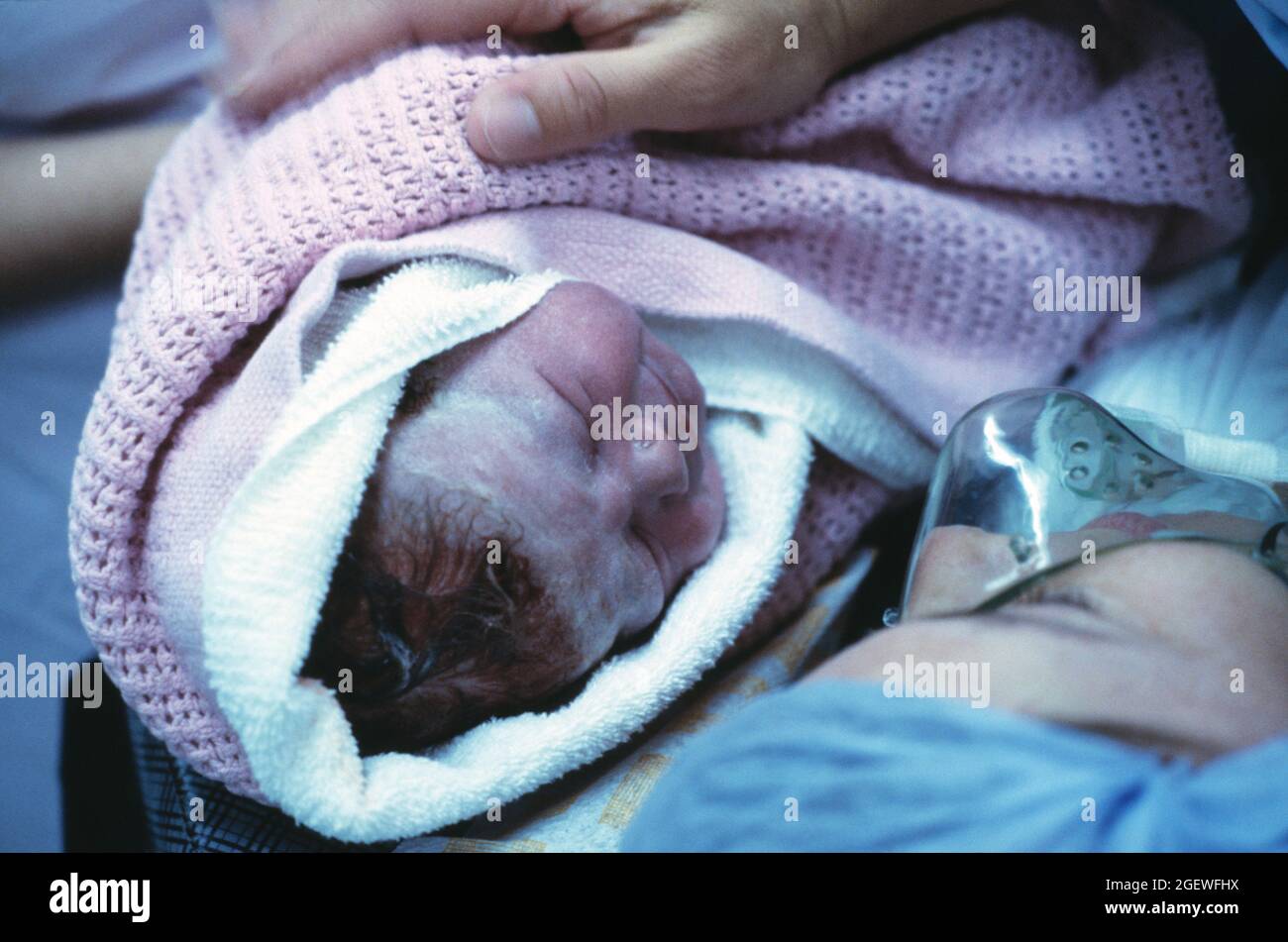 Medical hospital. Childbirth. Close up of newly born baby in mother's arms. Stock Photo
