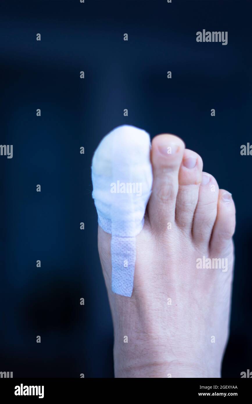 Foot big toe bandage injured feet in medical clinic hospital center