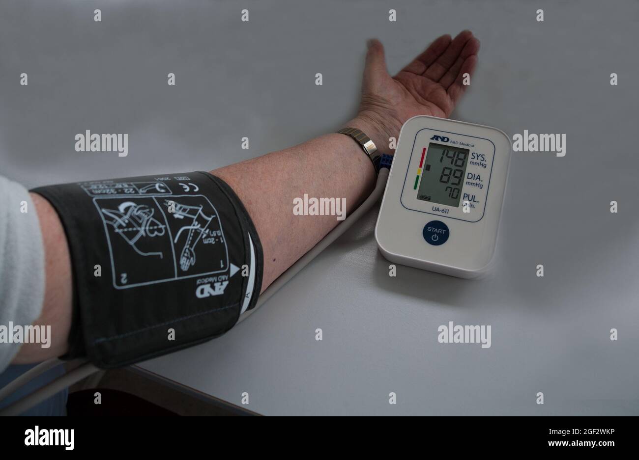 BP 170 At-Home Automatic Blood Pressure Monitor