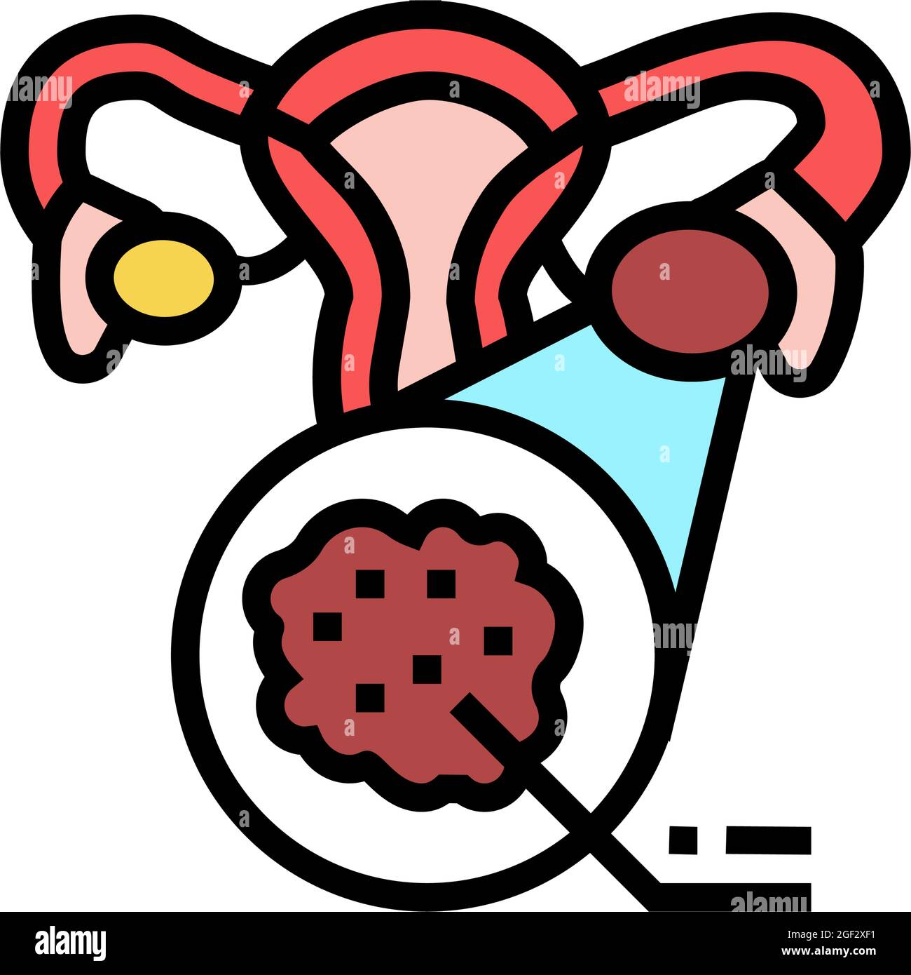 polycystic ovary syndrome endocrinology color icon vector illustration Stock Vector