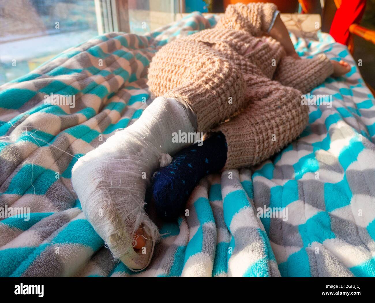 Child with bandage on leg heel fracture. Broken right foot, splint of