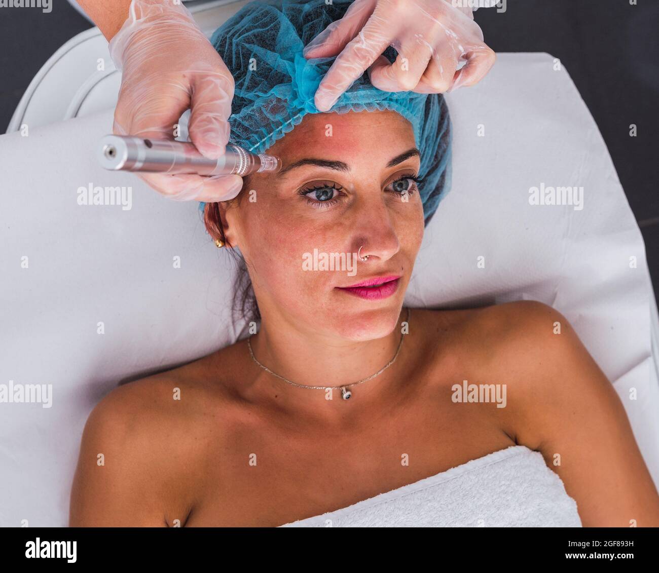 Professional cosmetologist performing procedure of mesotherapy with dermapen micro needles to adult woman Stock Photo